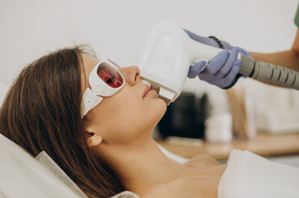 Laser Treatment for Skin